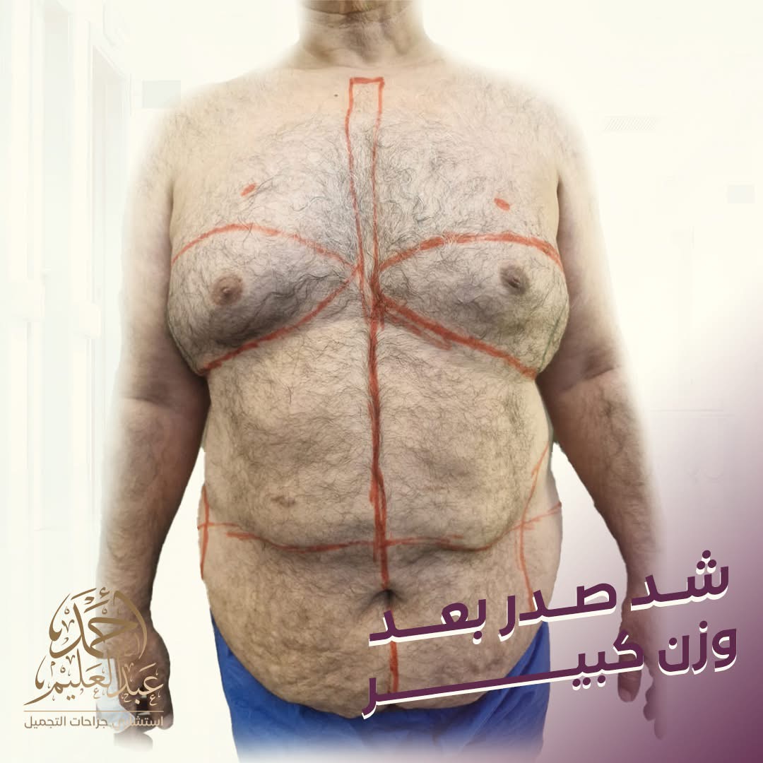 قبل شد صدر بعد وزن كبير