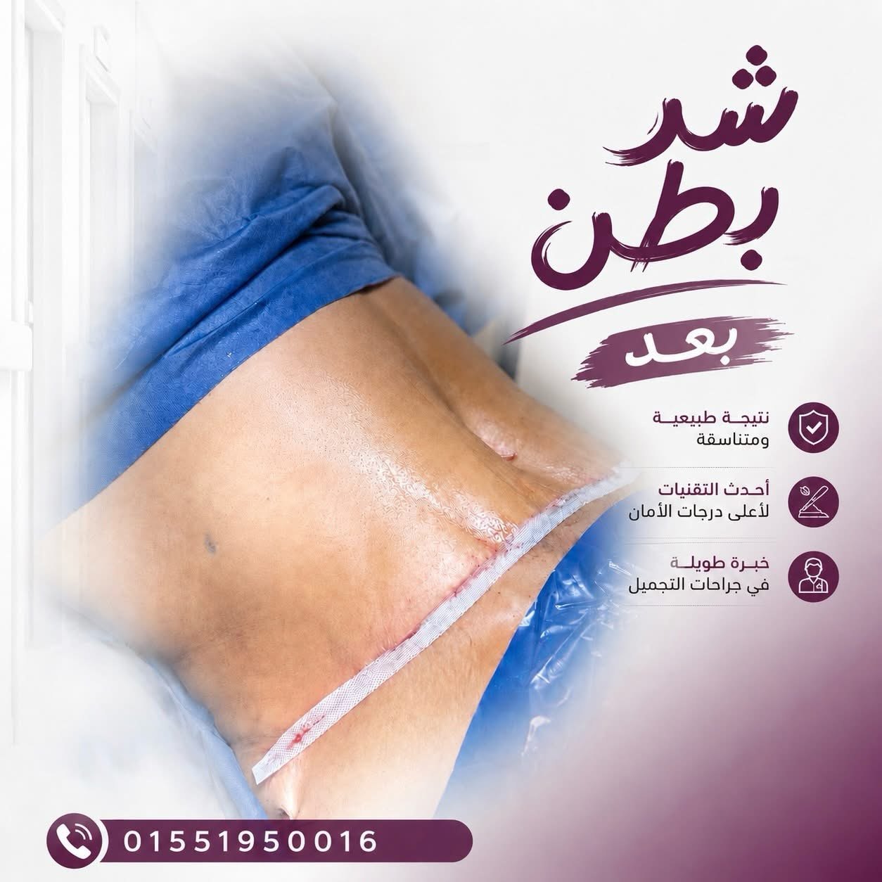 الفرق بين شفط الدهون وشد البطن